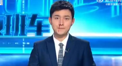 直播新聞噴鼻血！帥哥主播超淡定　全網瘋傳…他笑：只是上火啦！