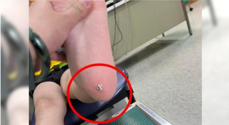 到樂園玩大海嘯！6歲男童竟被「刺進腳底」　網刷一排恐怖異物…噁爆了