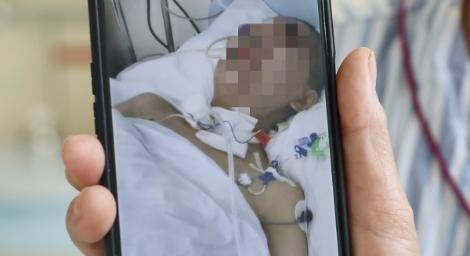 29歲女發燒39度「以為是感冒」抽搐昏迷2個月　醫生終於「撲滅腦中大火」