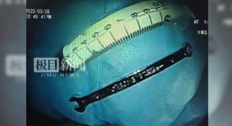 爸爸睡覺打呼！4歲兒子將「20公分長扳手」塞進嘴　整支吞下去…