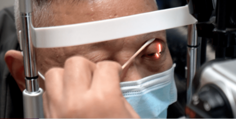 跟鱷魚一樣！男子「一吃東西就流淚」　醫：神經有毛病