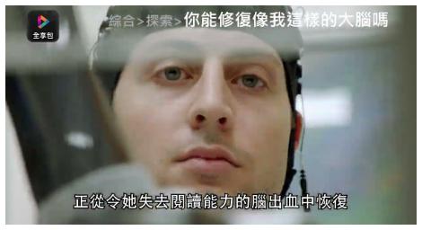 你能修復像我這樣的大腦嗎？帶你進入神經學以及大腦科學的世界