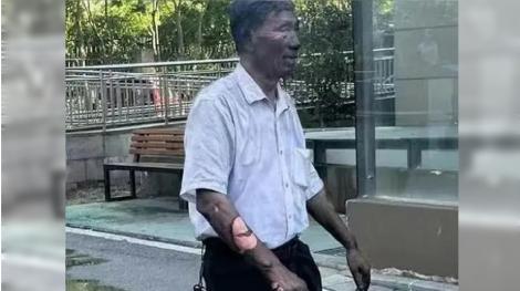 70歲翁當保安！盡忠職守衝火場救火…皮都掉了