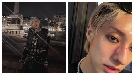 南韓同志歌手路邊散步遇襲…臉被灌一拳　陌生人怒罵：骯髒的gay