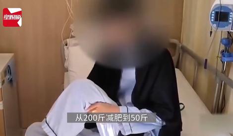 26歲女「玩命式減肥」只剩25公斤　靠「糞便」救回一命
