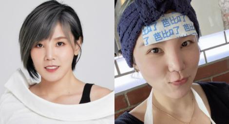 明明沒發燒！李佳薇用「退熱貼」芭比Q了　全網笑翻