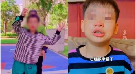 9歲腦癱男童怕「手術失敗會死掉」　錄影給媽媽：當妳兒子很幸福