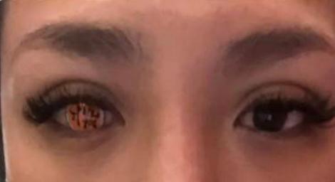 花1800買「鬼滅隱眼」款式錯誤！戴上變全盲　她怒威脅：檢舉賣家