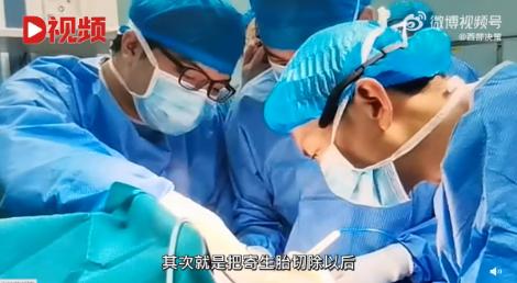 有圖慎入！男嬰出生竟「4手4腳」醫生立馬手術　照片曝光
