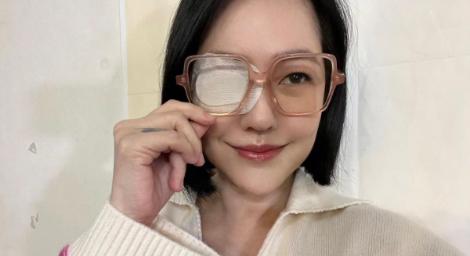 小S變獨眼龍！超大OK繃貼住右眼　受傷原因曝光