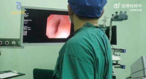 傻男想要「清舌苔」竟吞下18公分長牙刷　差點就要剖腹了